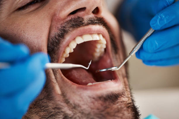 Best Urgent Dental Care for Toothaches in Mccormick, SC